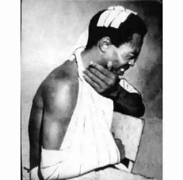 Photos Of Fela Kuti After Being Beaten Severely By Soldiers